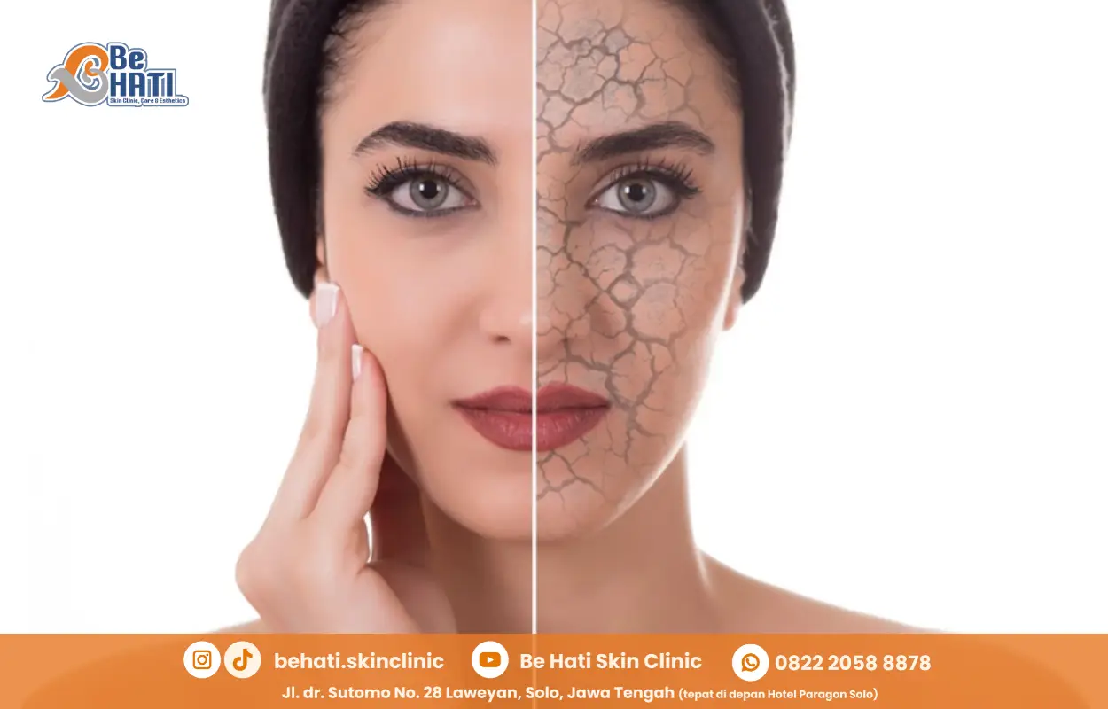 Skincare untuk Kulit Kering