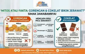 Gorengan & cokelat bikin jerawatan?