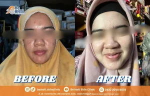 Ulasan positif Be Hati Lovers