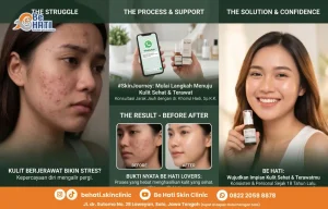 Perbandingan kulit wajah sebelum dan sesudah perawatan di Be Hati