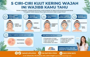 Ciri-ciri kulit kering