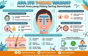 Apa itu t zone wajah?