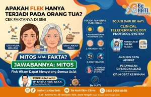 Perawatan flek hitam di Be Hati