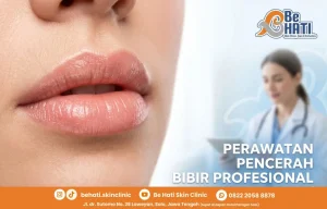 Perawatan bibir di Be Hati