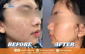 Perawatan kulit di Be Hati