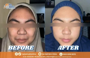 Ulasan Be Hati