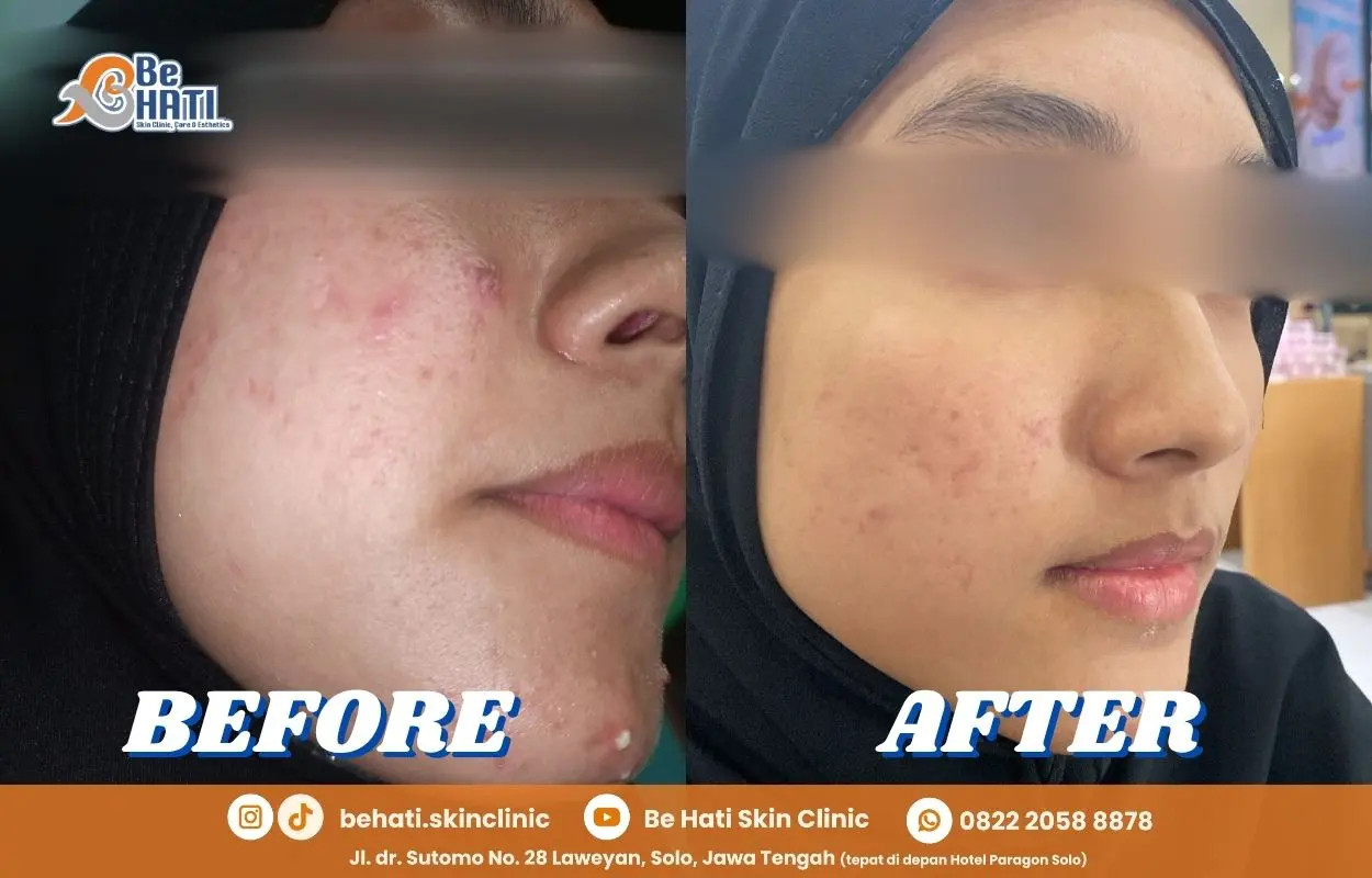 SkinJourney ulasan Be Hati