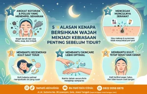Perlu membersihkan wajah sebelum tidur