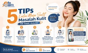 Tips keluar dari jerawatan