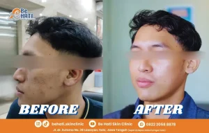 Testimoni Be Hati Skin Clinic