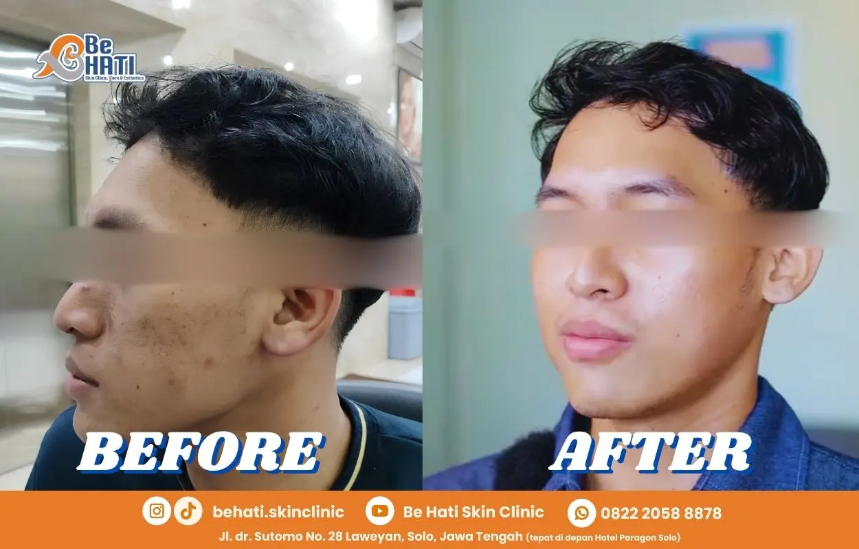 Testimoni Be Hati Skin Clinic