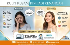 Masalah kulit kusam