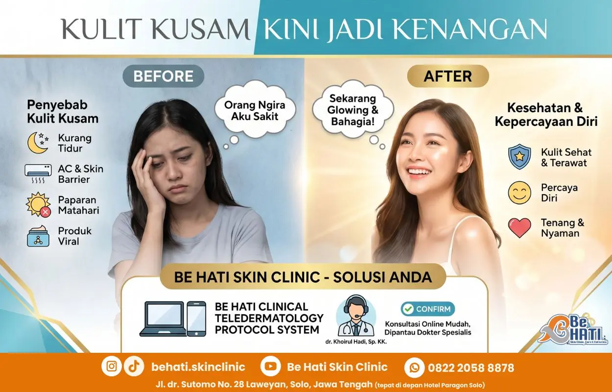 Masalah kulit kusam