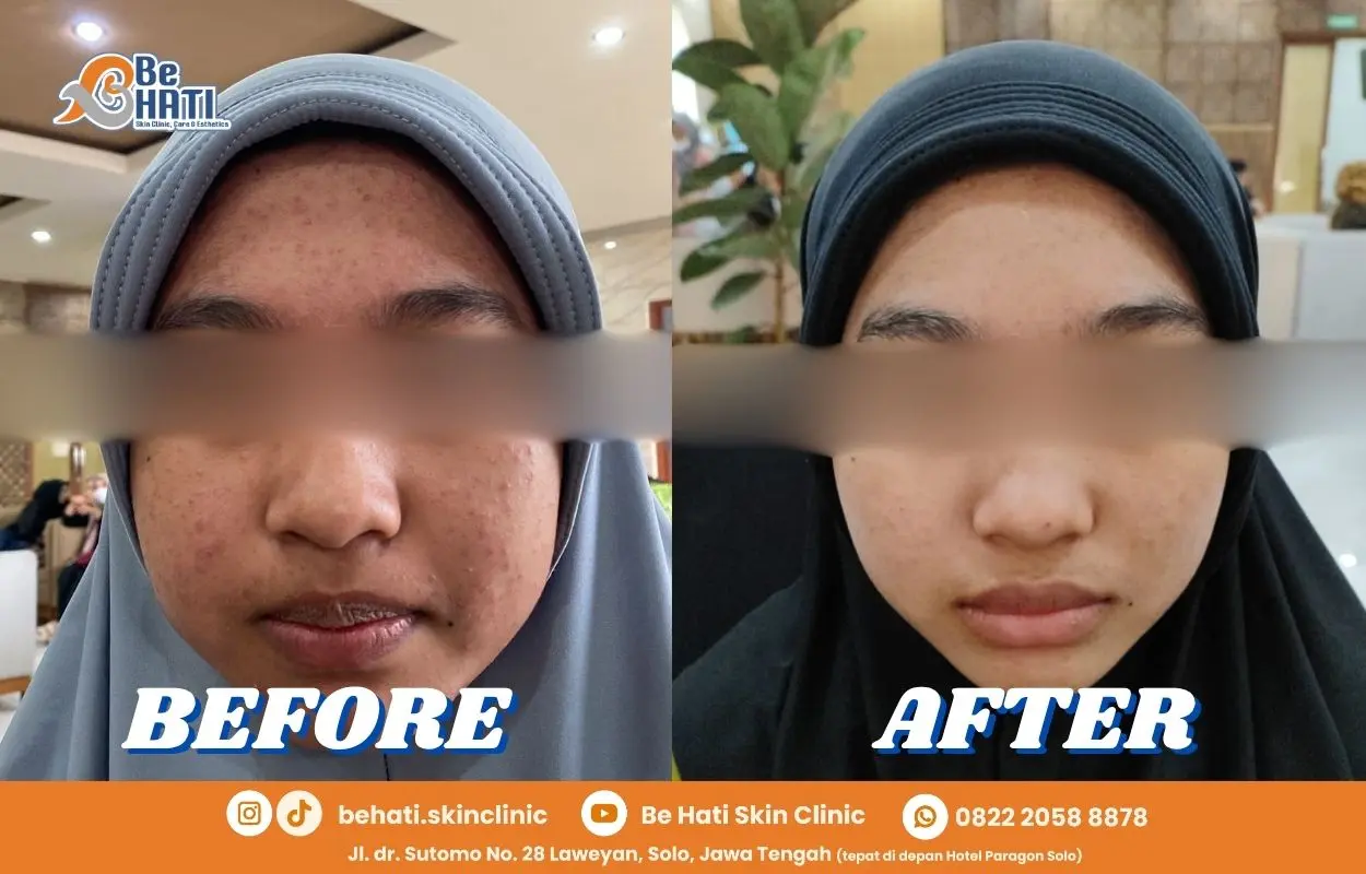 Testimoni Be Hati