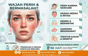 Tanda skin barier rusak