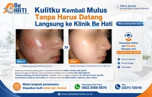 Konsultasi online di Be Hati hingga kulit kembali mulus