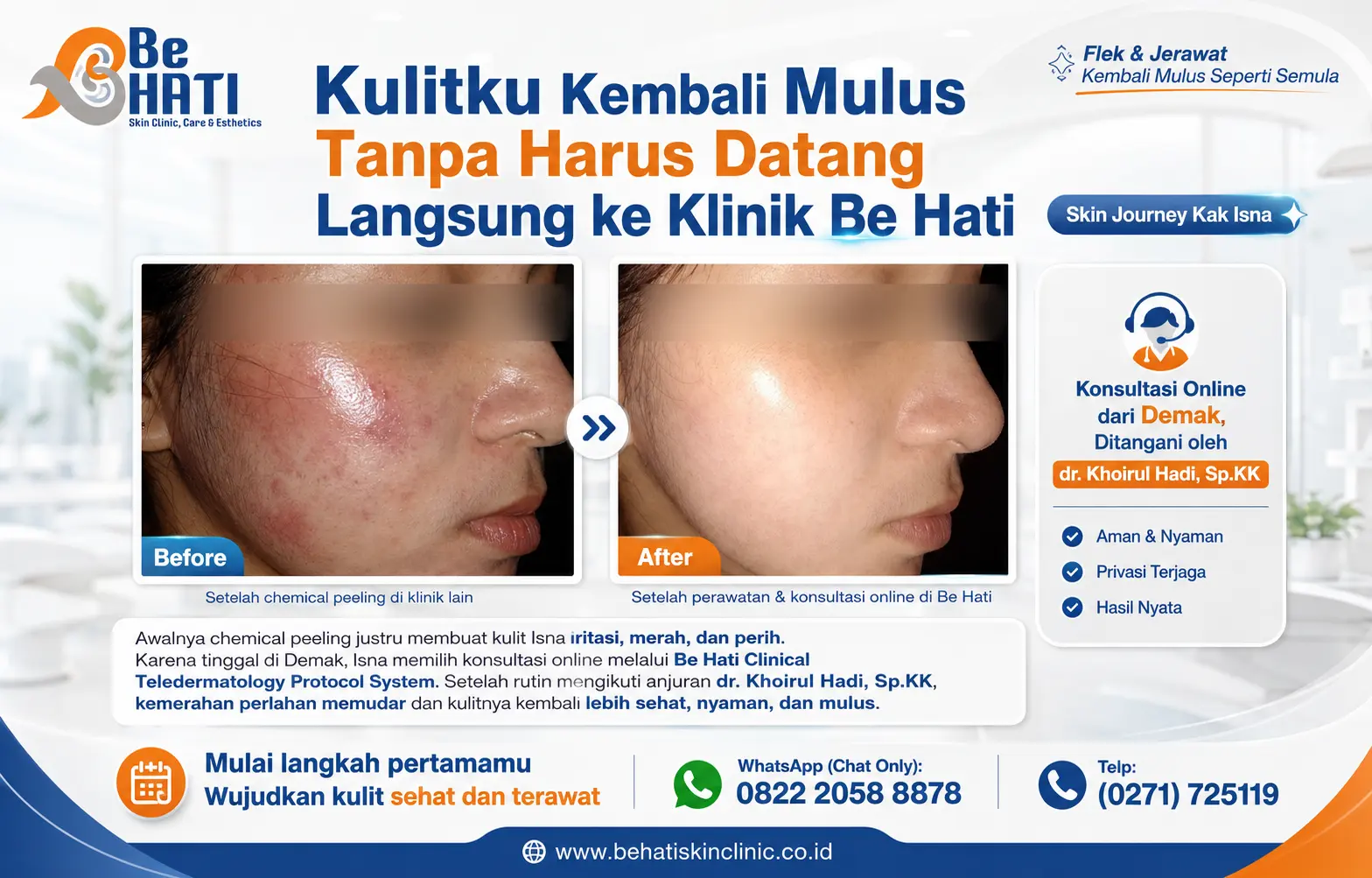 Konsultasi online di Be Hati hingga kulit kembali mulus