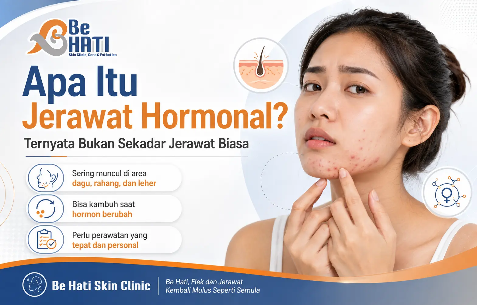 Perawatan jerawat di Be Hati Skin Clinic