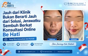 Perawatan online di Be Hati